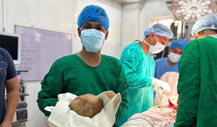 Mjekët kryejnë ndërhyrjen e rrallë, heqin gurin 3.1 kg nga fshikëza e një 55-vjeçari